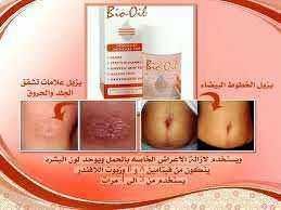 Bio-Oil: crema per la cura della pelle, riduce cicatrici e smagliature, migliorando l'aspetto della pelle in modo visibile. Ideale per tutte le tipologie di pelle e utilizzata quotidianamente.