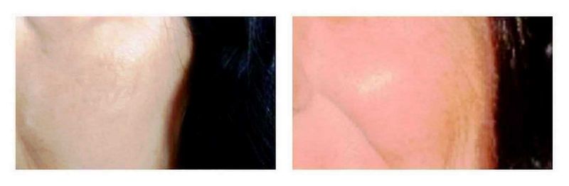 Cellnique Duo Pack creme Ultimate Glow for radiant skin 5 Confronto prima e dopo dell'aspetto della pelle durante l'esperienza con Cellnique