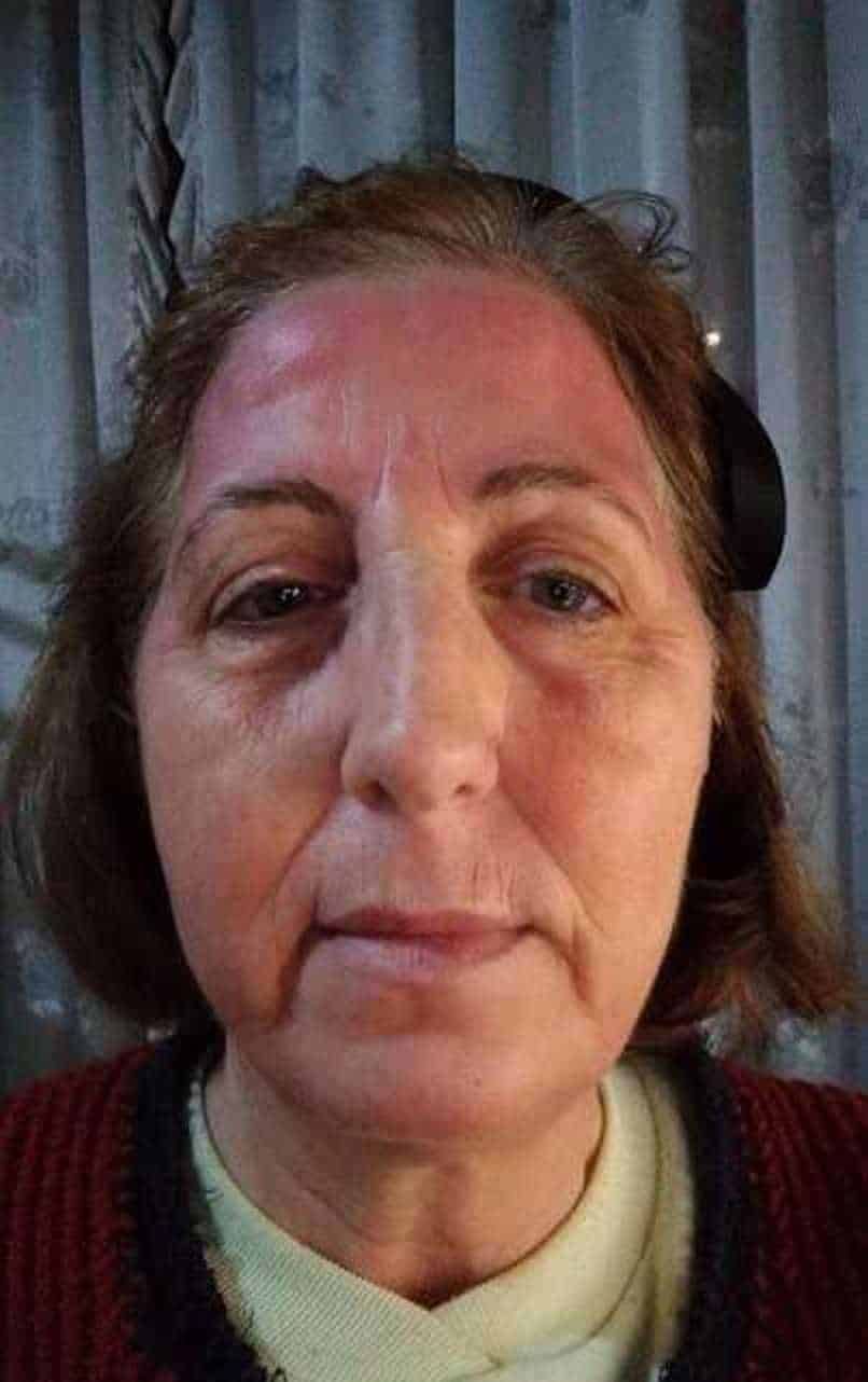 Bentonite Clay Mask, argilla curativa indiana Lotus 