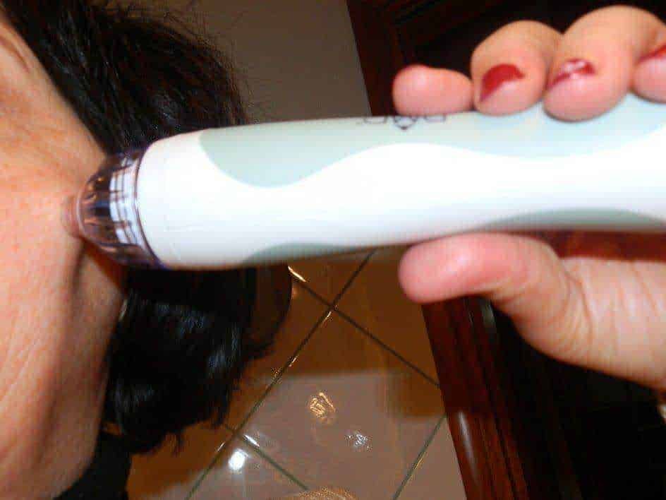 PMD personal microderm per pelle viso senza difetti