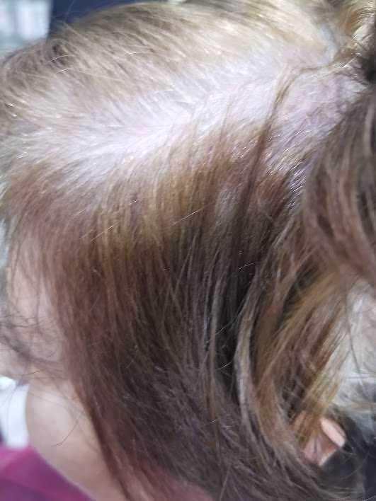 Oxy Station, ossigenoterapia per capelli sani e luminosi