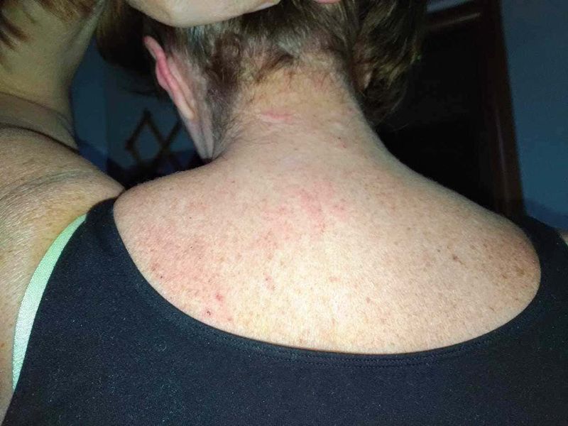 Bioderma Atoderm, migliore rimedio per pelle secca e irritata 3 Bioderma Atoderm, migliore rimedio per pelle secca e irritata