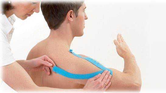Terapia fisioterapica per lesioni muscolari alla spalla con nastratura adesiva sportiva. Trattamento professionale del dolore muscolare e riabilitazione. Tecniche di fisioterapia specializzata per il recupero muscolare.