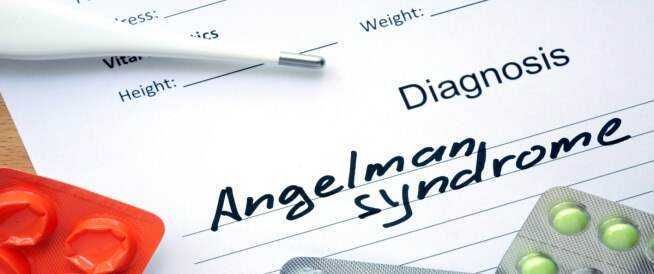Sindrome risata patologica, sintomi e cause