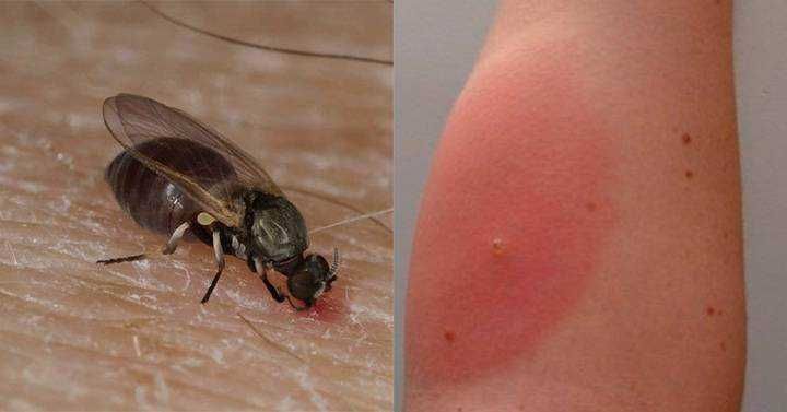 Come riconoscere le punture di insetti per curarsi bene 11 Morso di Tafano