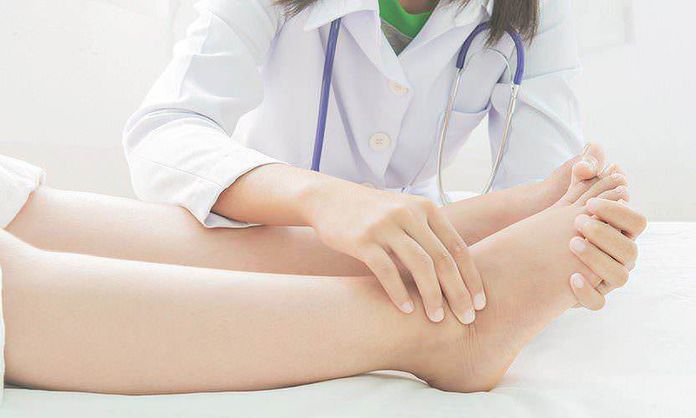 Lipedema sindrome gambe gonfie e trattamenti