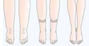 Piedi con diverse condizioni di salute, evidenziando variazioni delle dita e della pelle per una valutazione medica accurata. Tecniche e consigli per la cura dei piedi e prevenzione delle patologie.
