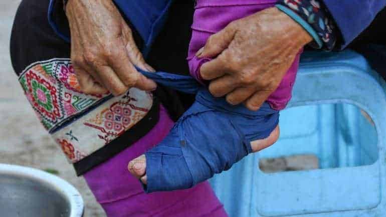 Fornitura di assistenza sanitaria a persone anziane con bendaggi e supporto medico, evidenziando servizi di cura e solidarietà.