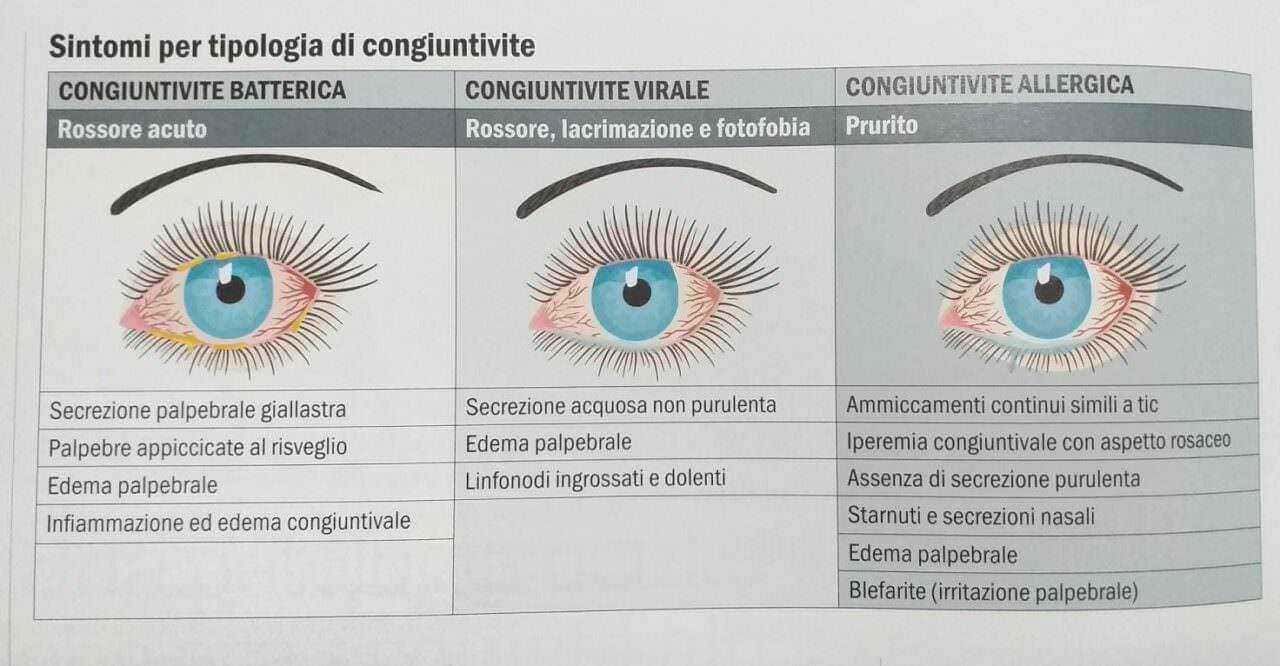 Congiuntivite covid cosa fare? Sintomi e rimedi