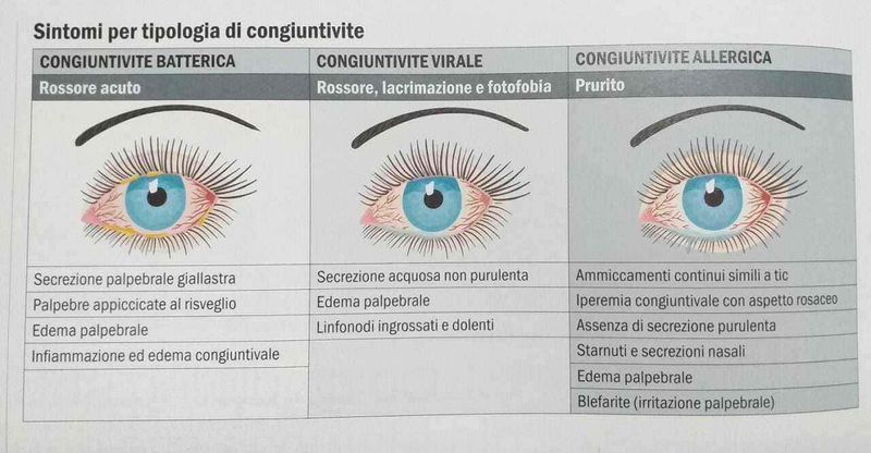 Congiuntivite covid cosa fare? Sintomi e rimedi 4 Congiuntivite covid cosa fare? Sintomi e rimedi