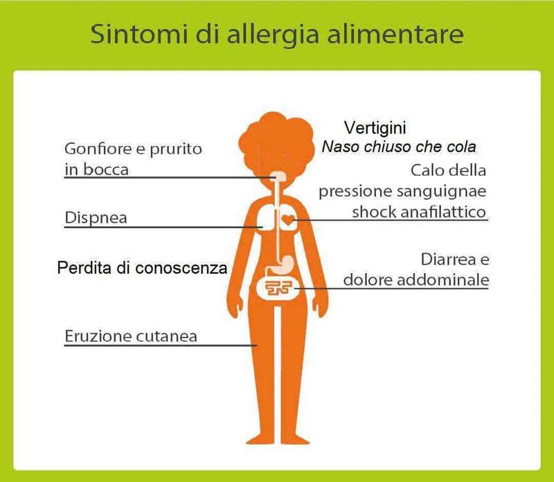 Allergia alimentare sintomi cutanei, cose da sapere 4 Iniezione di toxina botulinica sulla pelle del braccio, trattamento estetico per alleviare rughe e linee d'espressione. Procedure mediche di cosmetica minimamente invasiva.