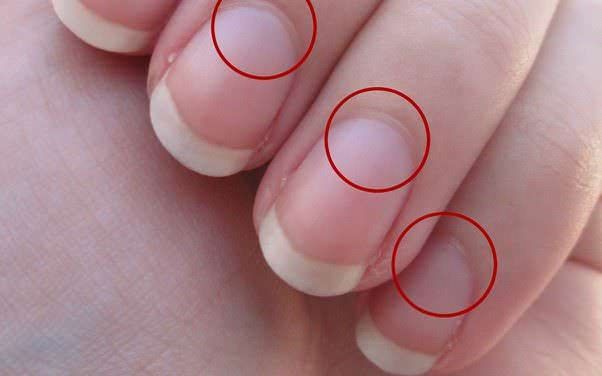 Cosa significa la lunetta piccolo alla base delle unghie?