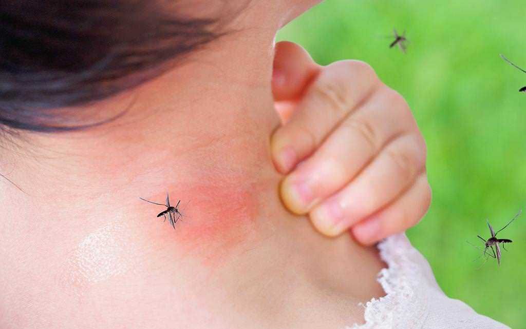 Piccolo bambino che si gratta il collo con zanzare intorno in un prato verde.