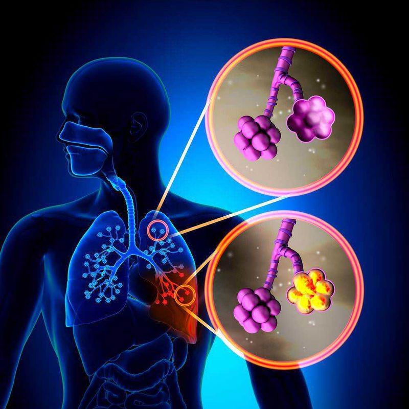 Come pulire i polmoni in 72 ore: cosa sapere davvero 2 Come pulire i polmoni in 72 ore: salute e anatomia dei polmoni
