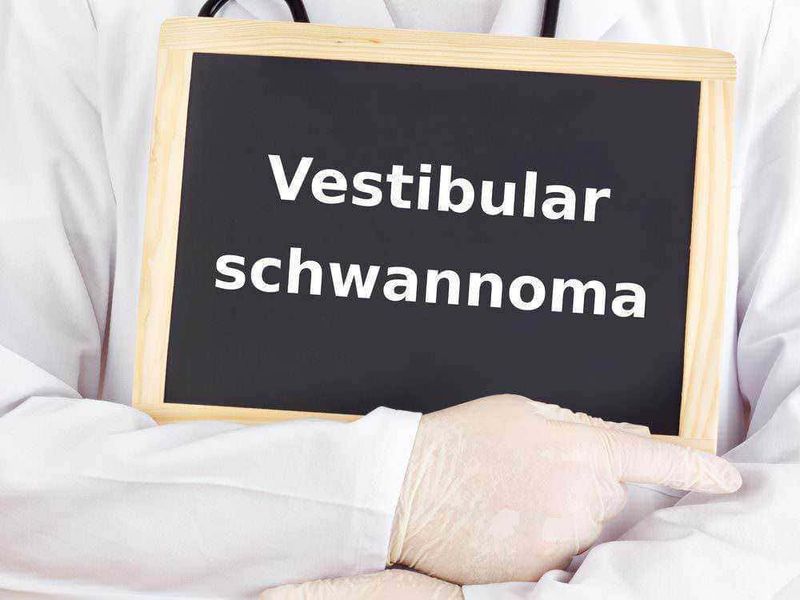 Neurinomi, cosa sono e come trattarli 2 Neurinoma acustico: Neurinomi, cosa sono e come trattarli
