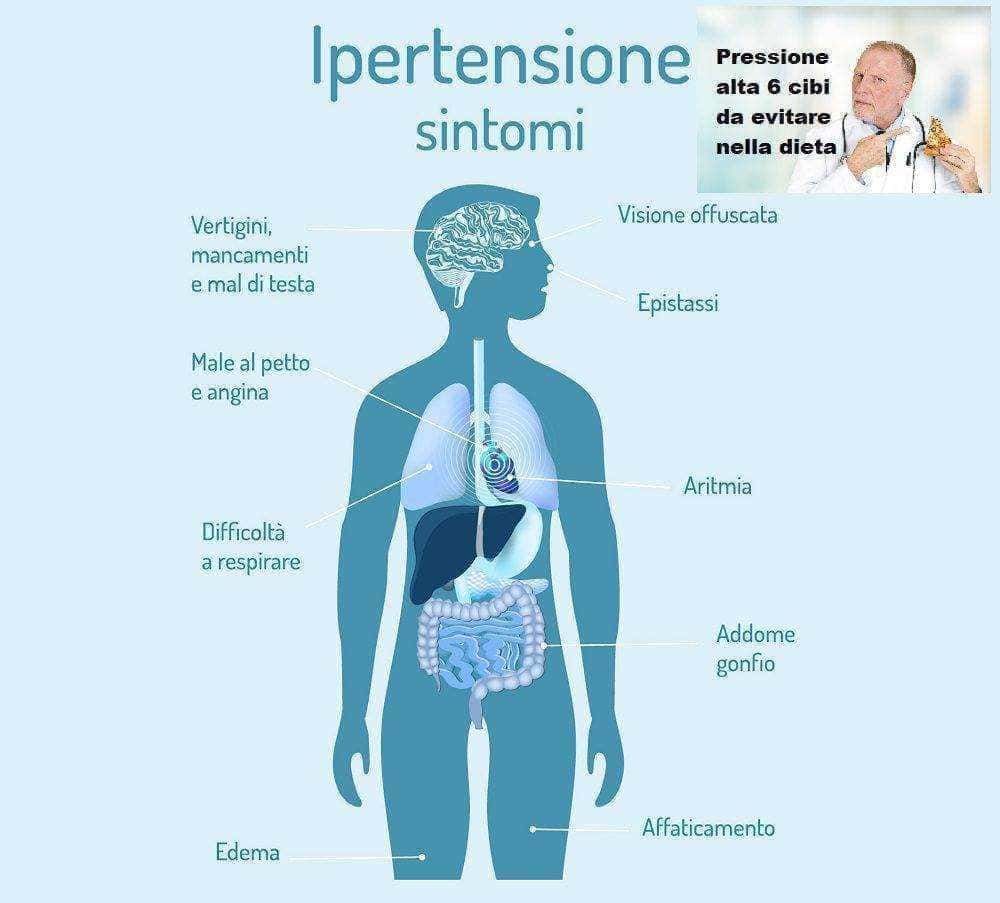 Pressione alta 6 cibi da evitare nella dieta - sintomi