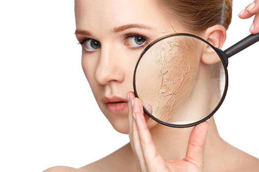 Pelle secca e screpolata, donna che utilizza lente d'ingrandimento per evidenziare le peeling o screpolature della pelle del viso, trattamento e cura della pelle.