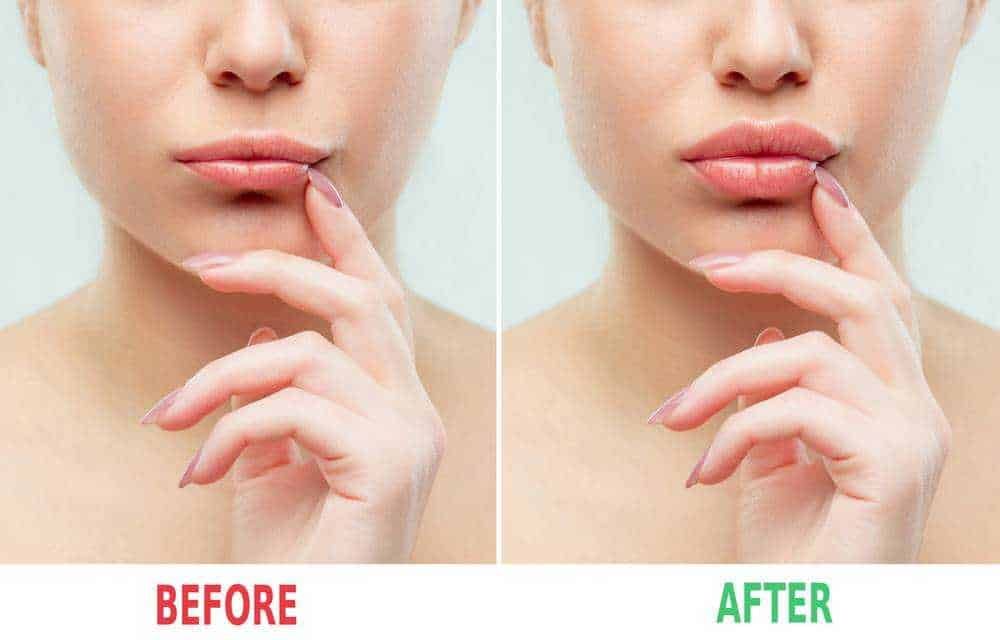 Pelle liscia e migliorata dopo trattamento di cura della pelle, prima e dopo confronto visivo, evidenzia efficacia di nuovi prodotti cosmetici, bellezza naturale, cura della skincare.