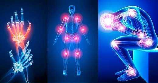 Tendinite, come curarla con prodotti naturali 4 alleviare-tendinite