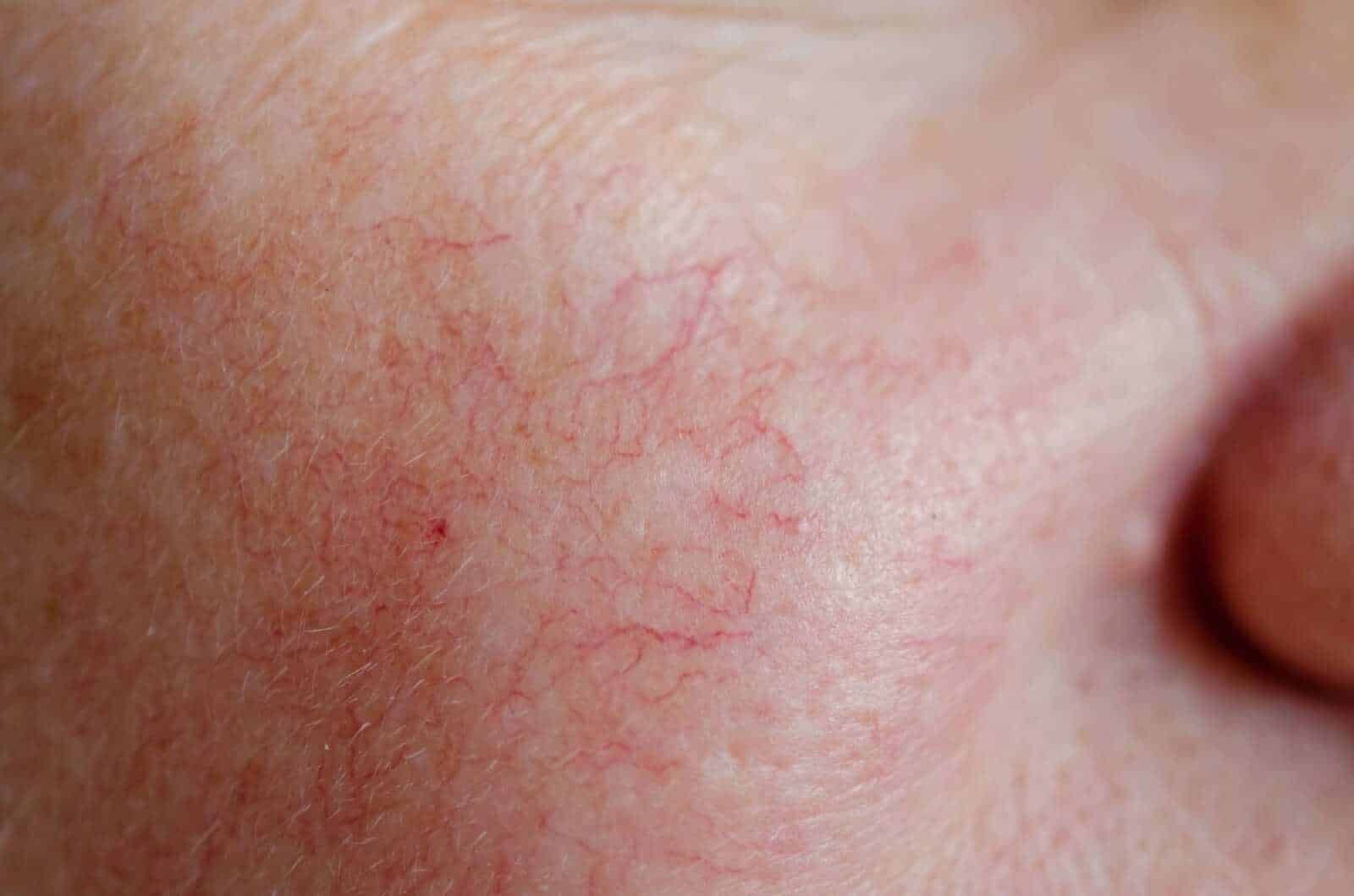Cosval non mi fare arrossire più