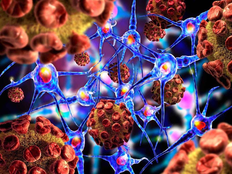 10 malattie autoimmuni gravi: quali sono e quali esami fare 2 10 malattie autoimmuni gravi: quali sono e quali esami fare.