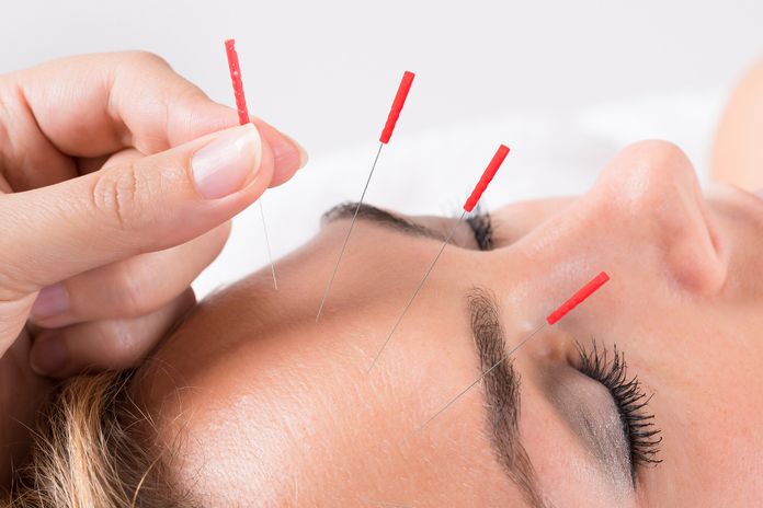 Agopuntura e vertigini 5 terapie convenzionali