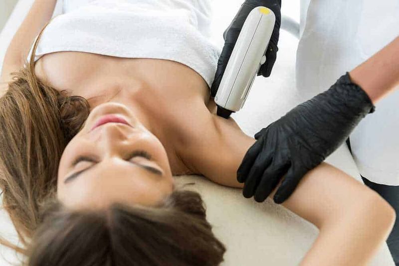 Epilazione laser alle ascelle: quanto dura e quanto è sicura? 4 Epilazione laser alle ascelle: quanto dura e quanto è sicura?