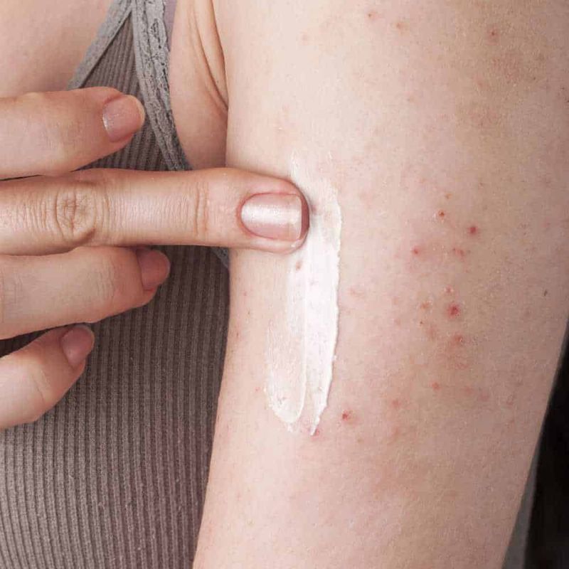 Differenza tra crema e unguento - pro e contro 3 Che differenza c'è tra crema e unguento? pro e contro