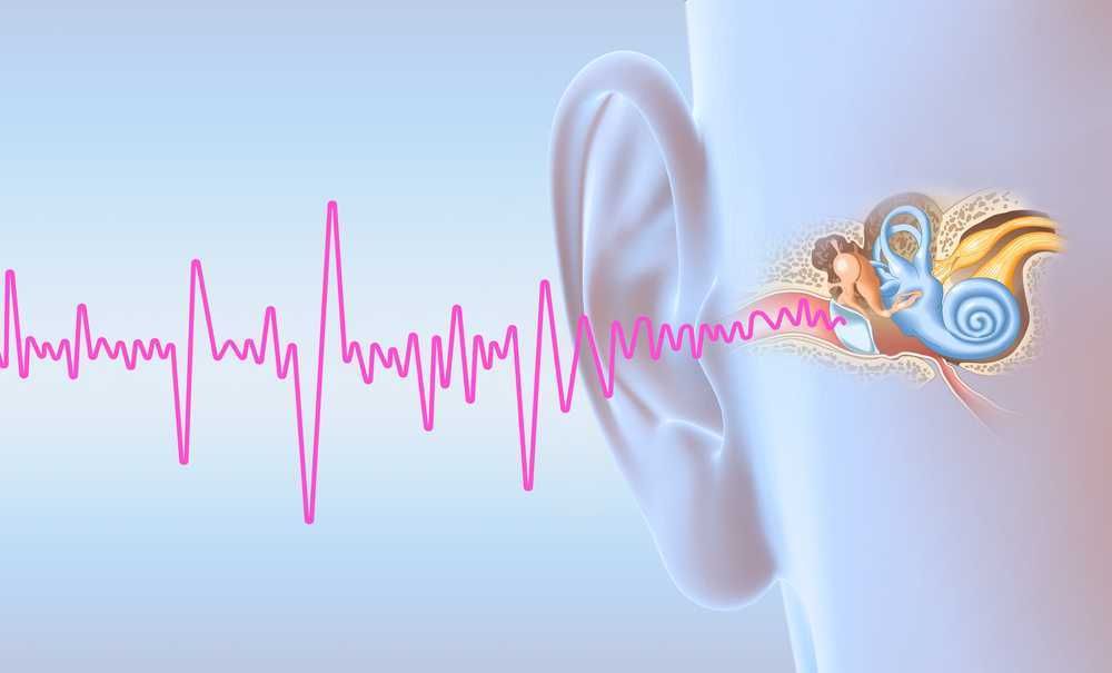 Acuto senso dell'udito rappresentato con un orecchio umano, impianto cocleare e onde sonore rosa. Immagine illustrativa per tecnologie uditive, salute dell'udito e innovazioni medicali.