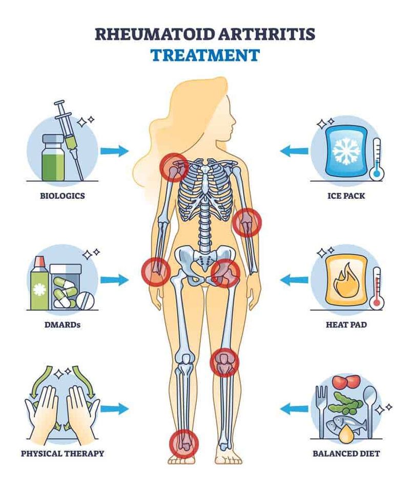 Dieta Seignalet per artrite reumatoide: consigli 2 Artrite reumatoide e dieta seignalet: Dieta Seignalet per artrite reumatoide: consigli