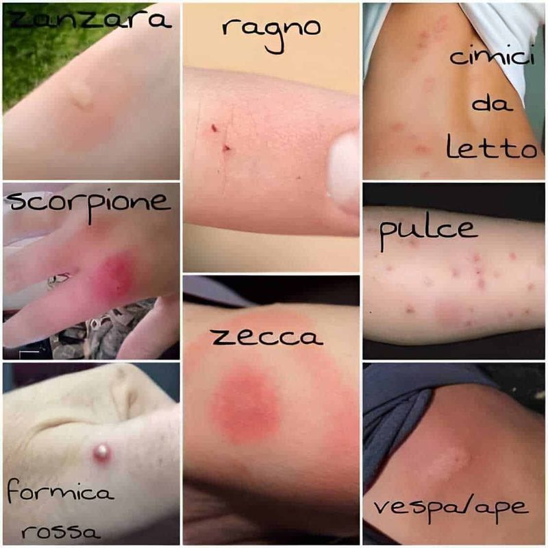 Come riconoscere le punture di insetti 2 Zanzara, ragno, cimici da letto, scorpione, zecca, pulce, formica rossa, vespA/ape: punture e irritazioni sulla pelle con immagini esplicative.