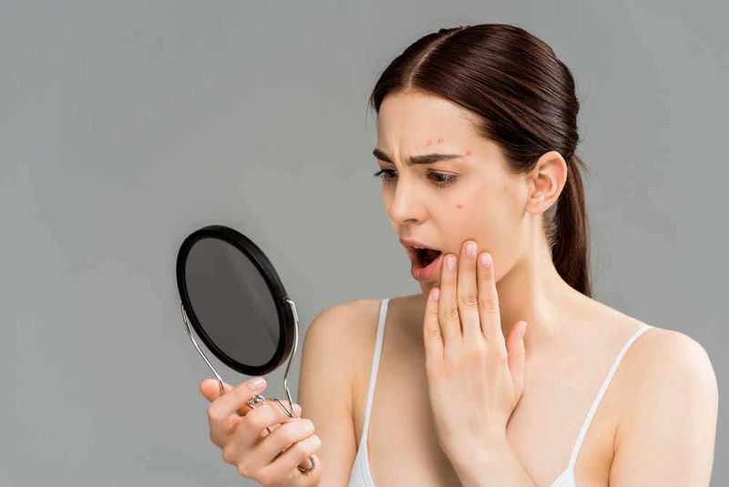 Come combattere l'acne: soluzioni e rimedi 3 Brutta acne sul volto di una donna giovane che si guarda nello specchio con espressione di sorpresa e preoccupazione.