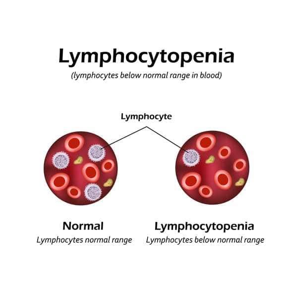 Come viene diagnosticata la linfopenia