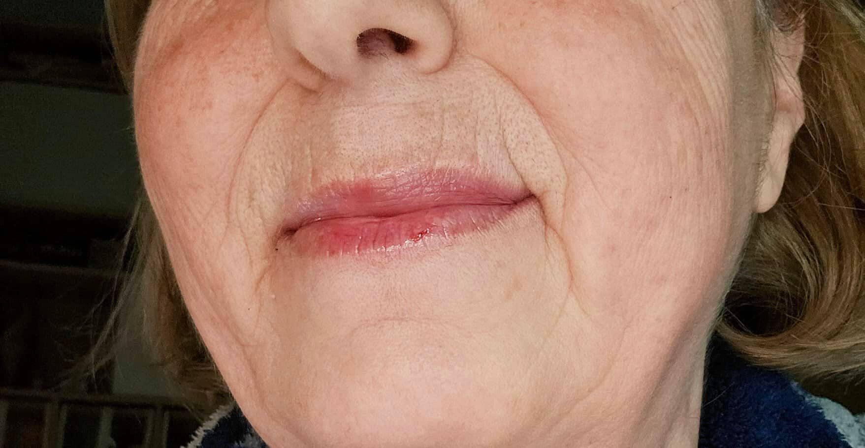 Pelle matura e rugosa con linee sottili intorno alle labbra e sulle guance, evidenziando i segni dell'età e l'esperienza.