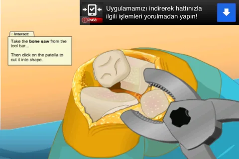 surgery-3 Virtual Surgery Pro iOS Uygulama İncelemesi