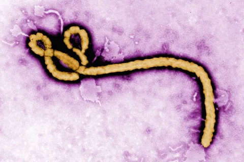 Ebola virüsünün Afrika’daki yayılma hızı düştü