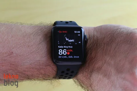 Yeni Apple Watch modellerinde EKG okuyucusu bulunabilir