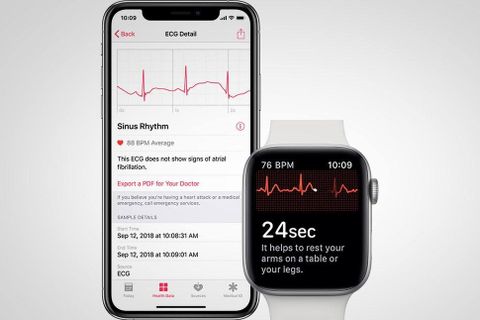 apple watch ekg