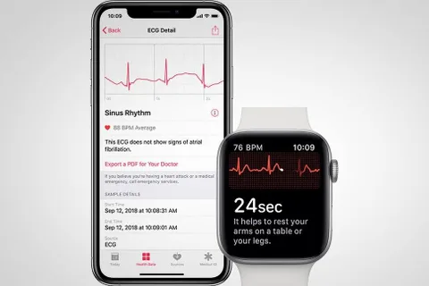 Apple Watch Series 4’e EKG özelliğinin gelişi yakın