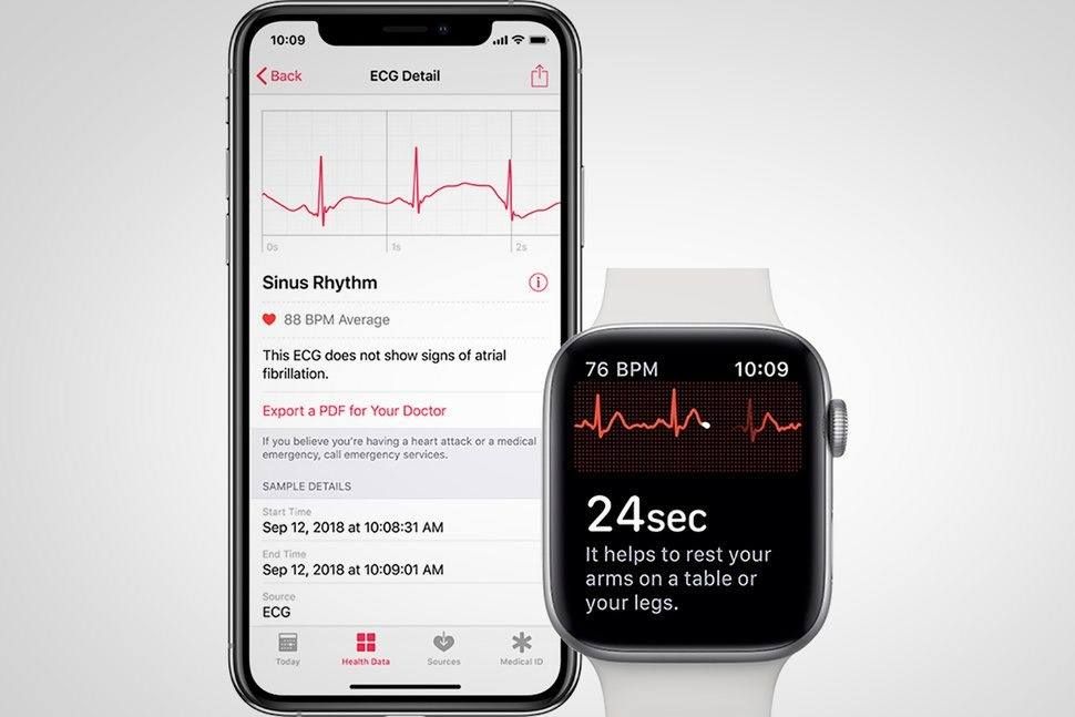 apple watch ekg