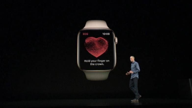 apple watch kalp ekg