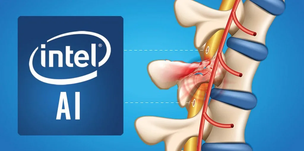 Intel yapay zekâ ile felçlileri yeniden ayağa kaldırmayı hedefliyor