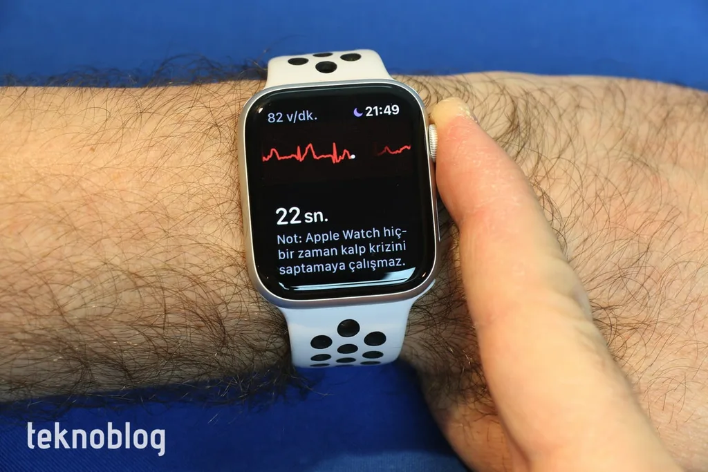 Hastanede çekilen EKG’de fark edilmeyen sorunu Apple Watch tespit etti