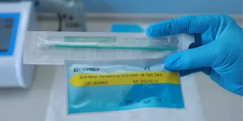 Koronavirüs için 15 dakikada sonuç veren hızlı tanı kitleri kullanımda