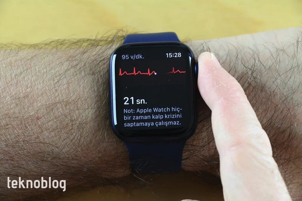 Apple Watch kalp ve damar yetmezliklerinin takibine yardımcı olabilir