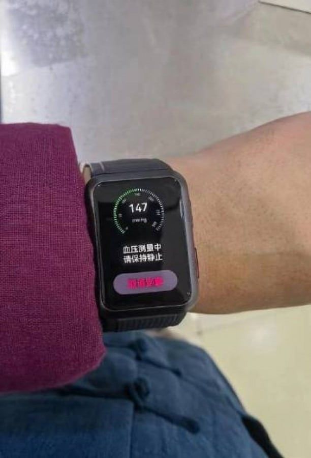 Huawei Watch D sızıntılarına bir yenisi daha eklendi