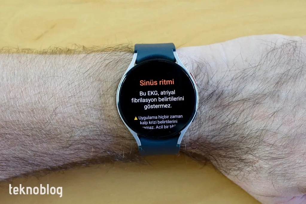 Samsung Galaxy Watch akıllı saatler de hayat kurtarıyor: İki ilginç vaka