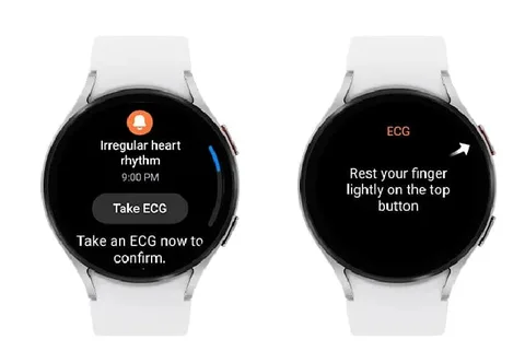 Samsung Galaxy Watch serisi kullanıcılarını kalpteki ritim bozukluğu konusunda uyaracak