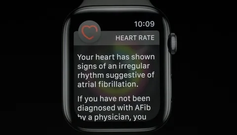 Tim Cook’tan Apple Watch ile hayatı kurtulanlara geri dönüş