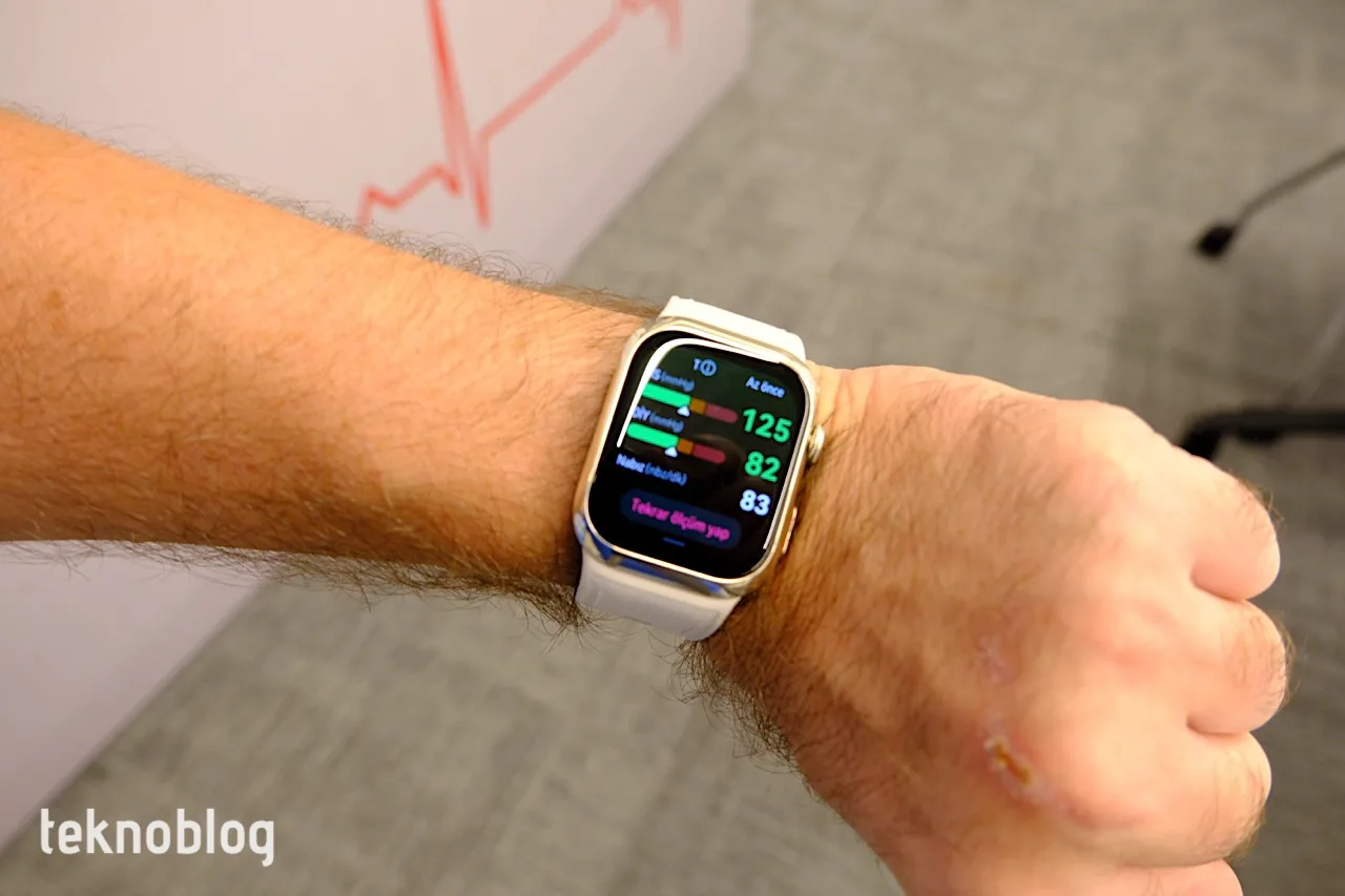 Huawei Watch D2 ile kan basıncı takibi daha hassas ve erişilebilir